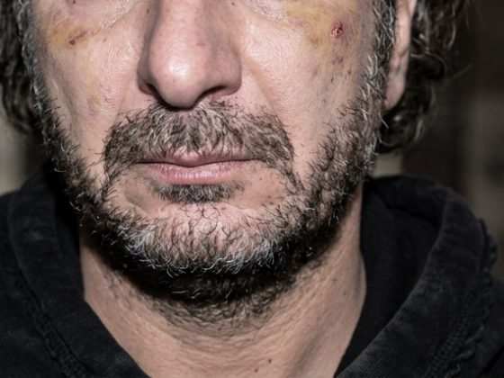 Home jacking chez Michaël Youn